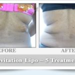 before-after-example3